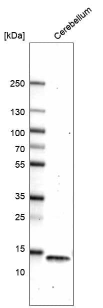 Parvalbumin Antibody (CL15070) [Unconjugated] Western blot: Parvalbumin Antibody (CL15070) [NBP3-43649]