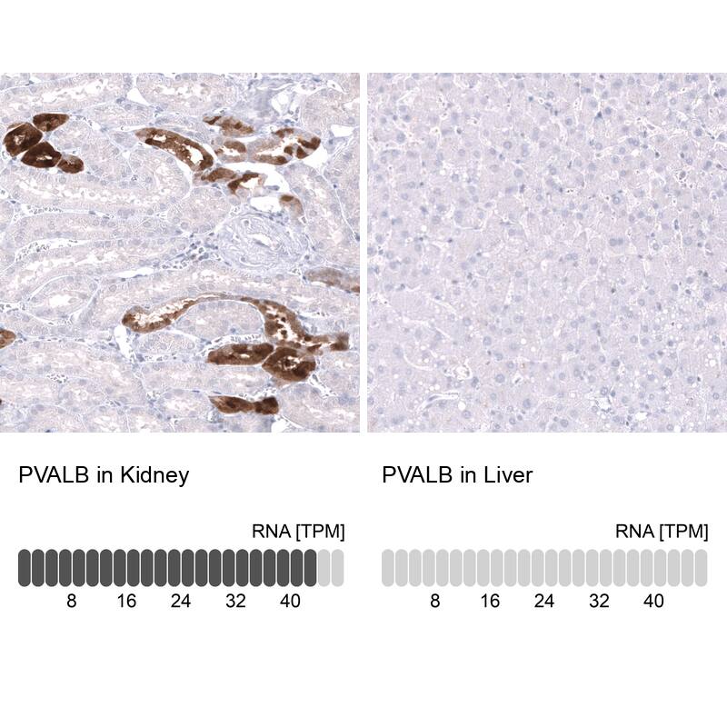 Parvalbumin Antibody (CL15070) [Unconjugated] Immunohistochemistry-Paraffin: Parvalbumin Antibody (CL15070) [NBP3-43649]