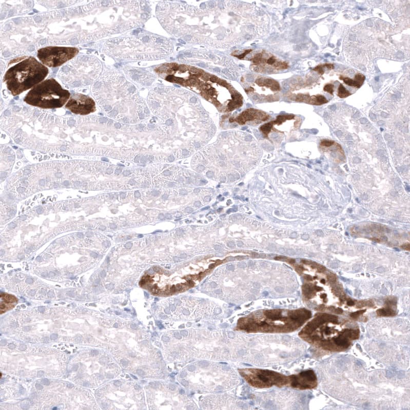 Parvalbumin Antibody (CL15070) [Unconjugated] Immunohistochemistry-Paraffin: Parvalbumin Antibody (CL15070) [NBP3-43649]