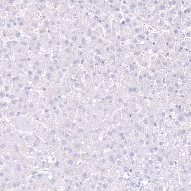 Parvalbumin Antibody (CL15070) [Unconjugated] Immunohistochemistry-Paraffin: Parvalbumin Antibody (CL15070) [NBP3-43649]