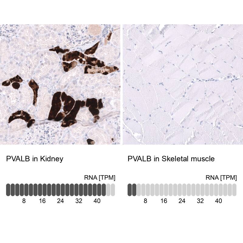 Parvalbumin Antibody (CL15072) [Unconjugated] Immunohistochemistry-Paraffin: Parvalbumin Antibody (CL15072) [NBP3-43650]