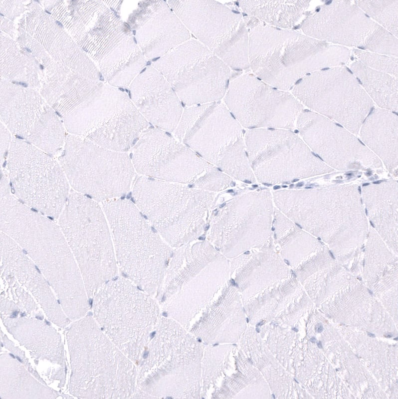 Parvalbumin Antibody (CL15072) [Unconjugated] Immunohistochemistry-Paraffin: Parvalbumin Antibody (CL15072) [NBP3-43650]