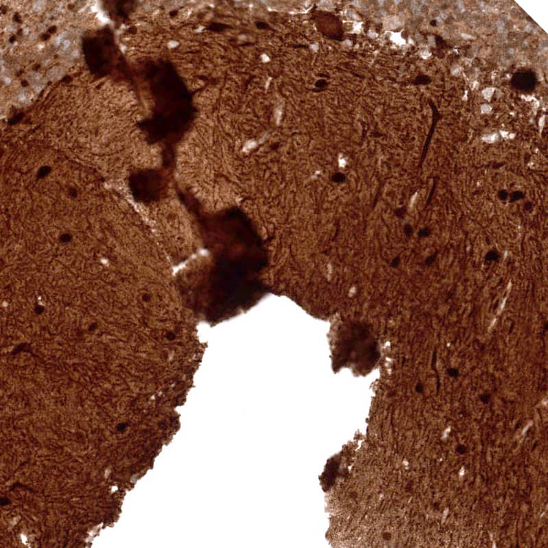 Parvalbumin Antibody (CL15072) [Unconjugated] Immunohistochemistry-Paraffin: Parvalbumin Antibody (CL15072) [NBP3-43650]