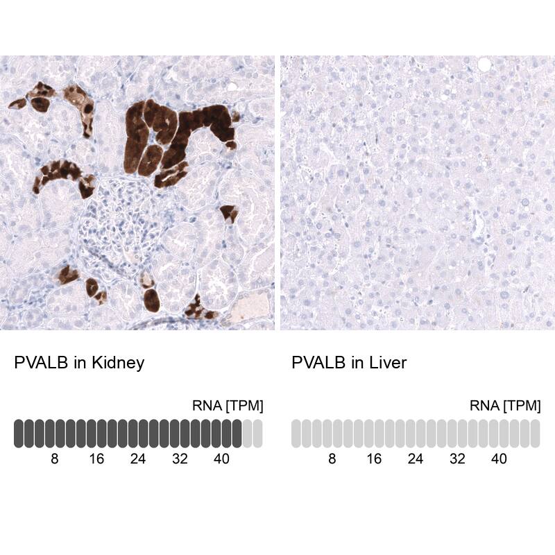 Parvalbumin Antibody (CL15073) [Unconjugated] Immunohistochemistry-Paraffin: Parvalbumin Antibody (CL15073) [NBP3-43651]