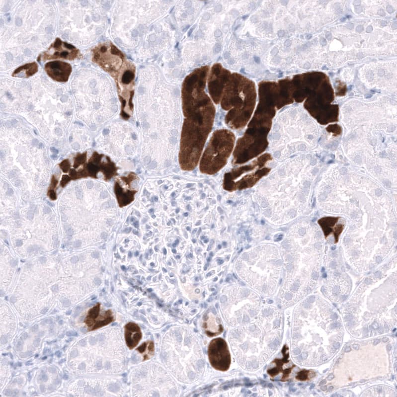 Parvalbumin Antibody (CL15073) [Unconjugated] Immunohistochemistry-Paraffin: Parvalbumin Antibody (CL15073) [NBP3-43651]