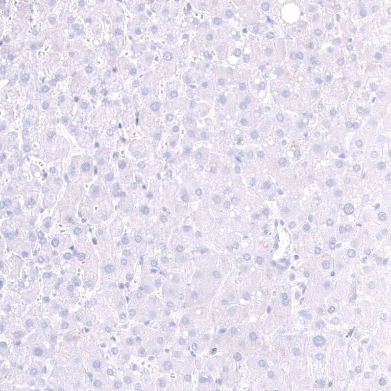 Parvalbumin Antibody (CL15073) [Unconjugated] Immunohistochemistry-Paraffin: Parvalbumin Antibody (CL15073) [NBP3-43651]