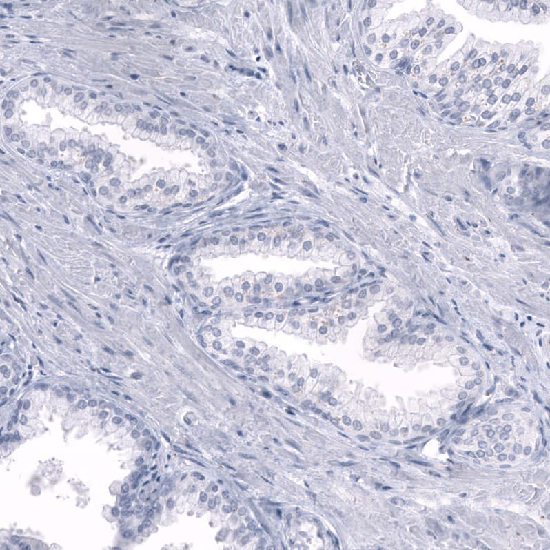 Somatostatin Antibody (CL15075) [Unconjugated] Immunohistochemistry-Paraffin: Somatostatin Antibody (CL15075) [NBP3-43652]