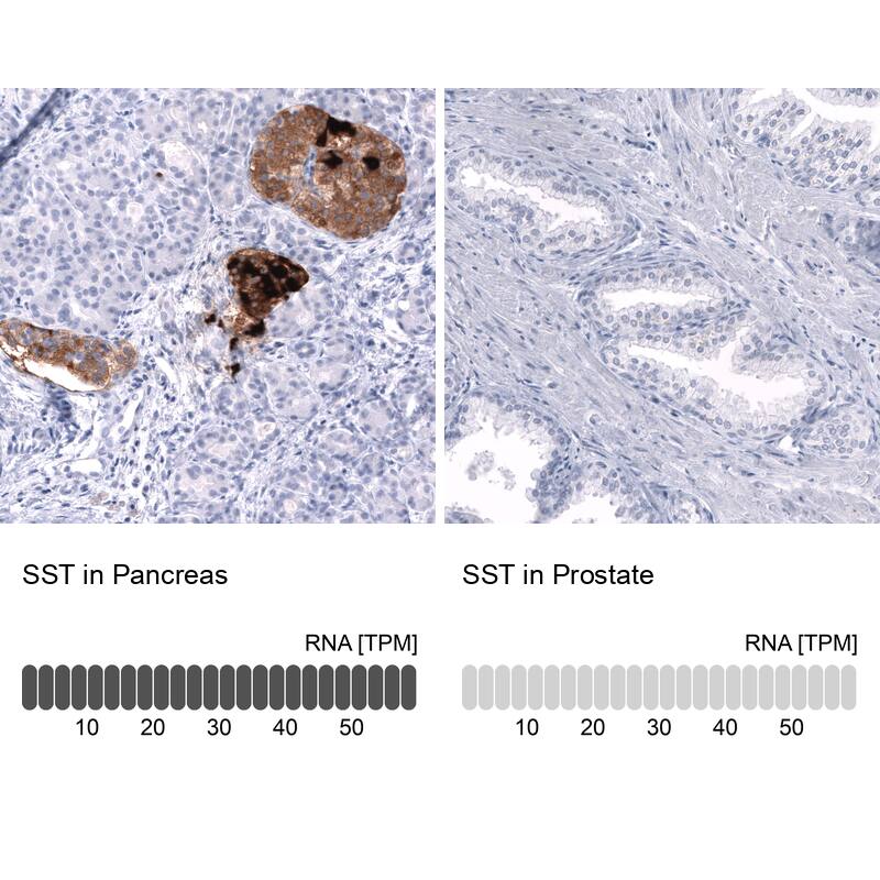 Somatostatin Antibody (CL15075) [Unconjugated] Immunohistochemistry-Paraffin: Somatostatin Antibody (CL15075) [NBP3-43652]