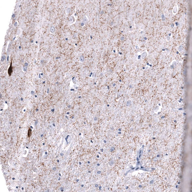 Somatostatin Antibody (CL15075) [Unconjugated] Immunohistochemistry-Paraffin: Somatostatin Antibody (CL15075) [NBP3-43652]