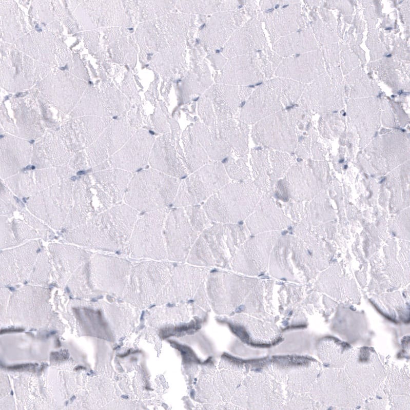 Somatostatin Antibody (CL15076) [Unconjugated] Immunohistochemistry-Paraffin: Somatostatin Antibody (CL15076) [NBP3-43653]