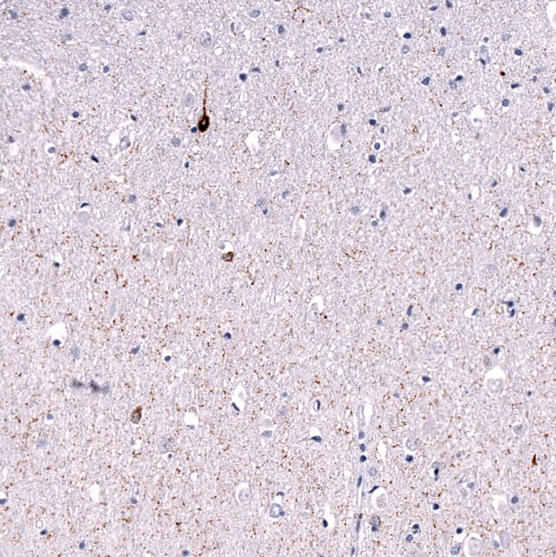 Somatostatin Antibody (CL15076) [Unconjugated] Immunohistochemistry-Paraffin: Somatostatin Antibody (CL15076) [NBP3-43653]