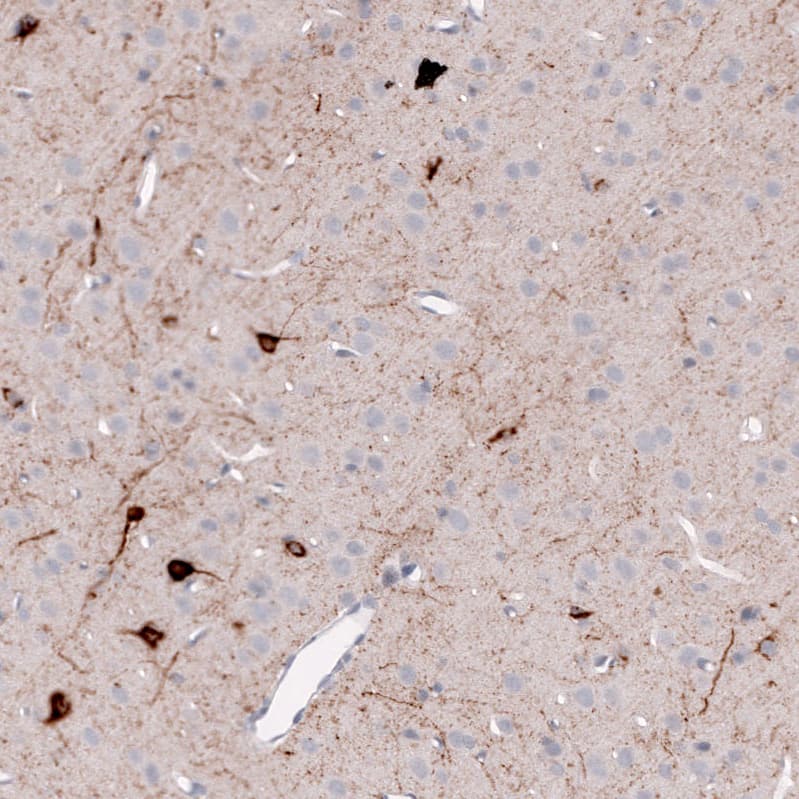 Somatostatin Antibody (CL15076) [Unconjugated] Immunohistochemistry-Paraffin: Somatostatin Antibody (CL15076) [NBP3-43653]