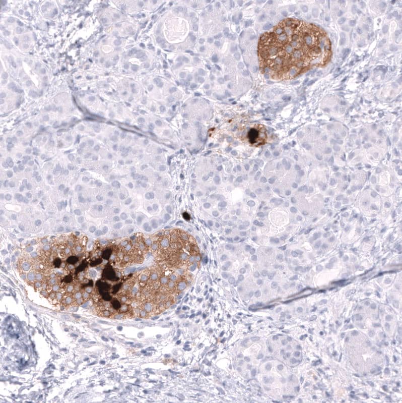 Somatostatin Antibody (CL15076) [Unconjugated] Immunohistochemistry-Paraffin: Somatostatin Antibody (CL15076) [NBP3-43653]