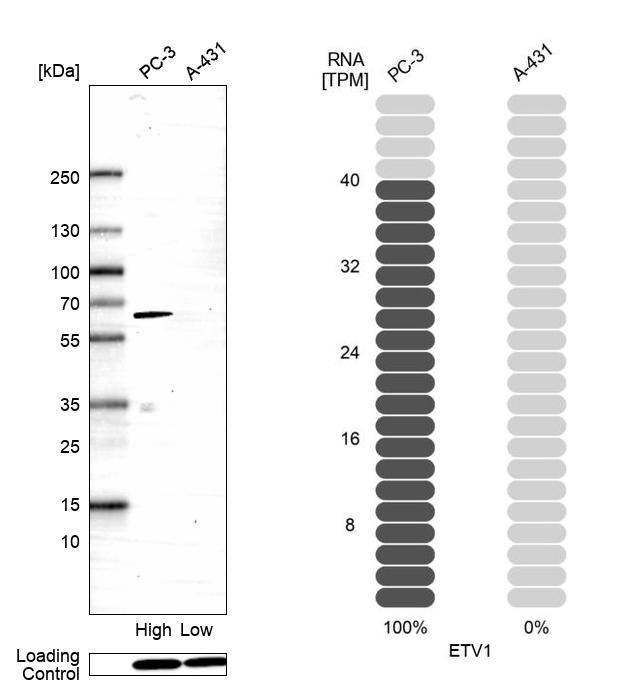 ETV1 Antibody (CL15257) [Unconjugated] Western blot: ETV1 Antibody (CL15257) [NBP3-43654]