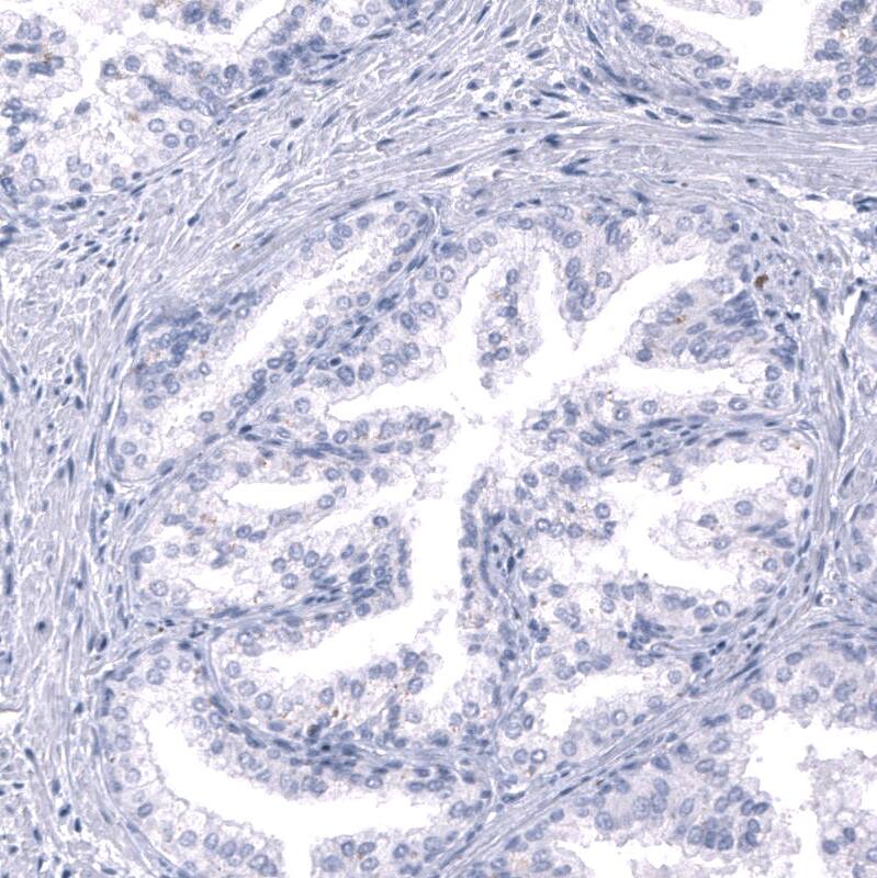 Nociceptin Antibody (CL15085) [Unconjugated] Immunohistochemistry-Paraffin: Nociceptin Antibody (CL15085) [NBP3-43655]