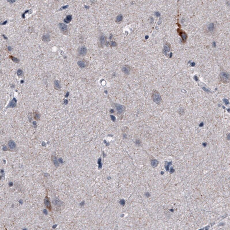 Nociceptin Antibody (CL15085) [Unconjugated] Immunohistochemistry-Paraffin: Nociceptin Antibody (CL15085) [NBP3-43655]