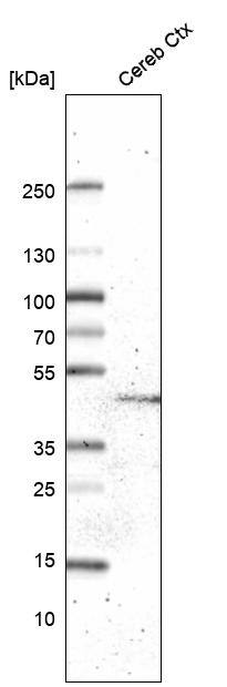 GPR88 Antibody (CL15190) [Unconjugated] Western blot: GPR88 Antibody (CL15190) [NBP3-43656]