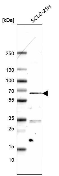 ETV1 Antibody (CL15251) [Unconjugated] Western blot: ETV1 Antibody (CL15251) [NBP3-43657]