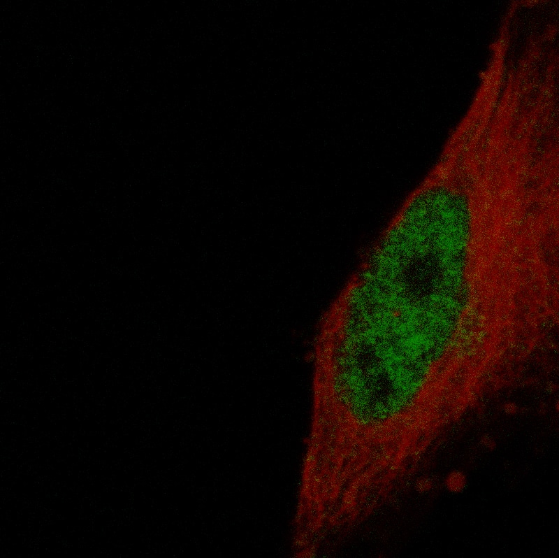 ETV1 Antibody (CL15251) [Unconjugated] Immunocytochemistry/ Immunofluorescence : ETV1 Antibody (CL15251) [NBP3-43657]
