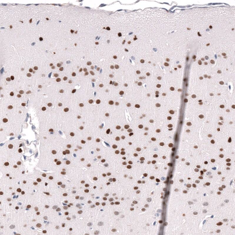 POU3F3 Antibody (CL15302) [Unconjugated] Immunohistochemistry-Paraffin: POU3F3 Antibody (CL15302) [NBP3-43659]