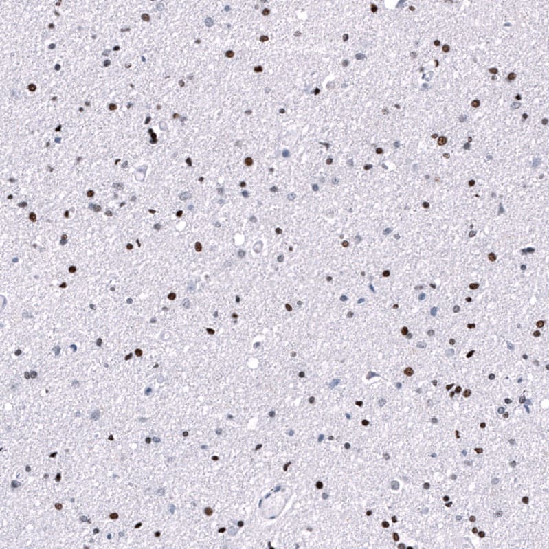 POU3F3 Antibody (CL15308) [Unconjugated] Immunohistochemistry-Paraffin: POU3F3 Antibody (CL15308) [NBP3-43660]