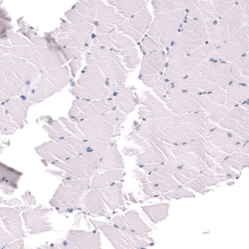 POU3F3 Antibody (CL15308) [Unconjugated] Immunohistochemistry-Paraffin: POU3F3 Antibody (CL15308) [NBP3-43660]