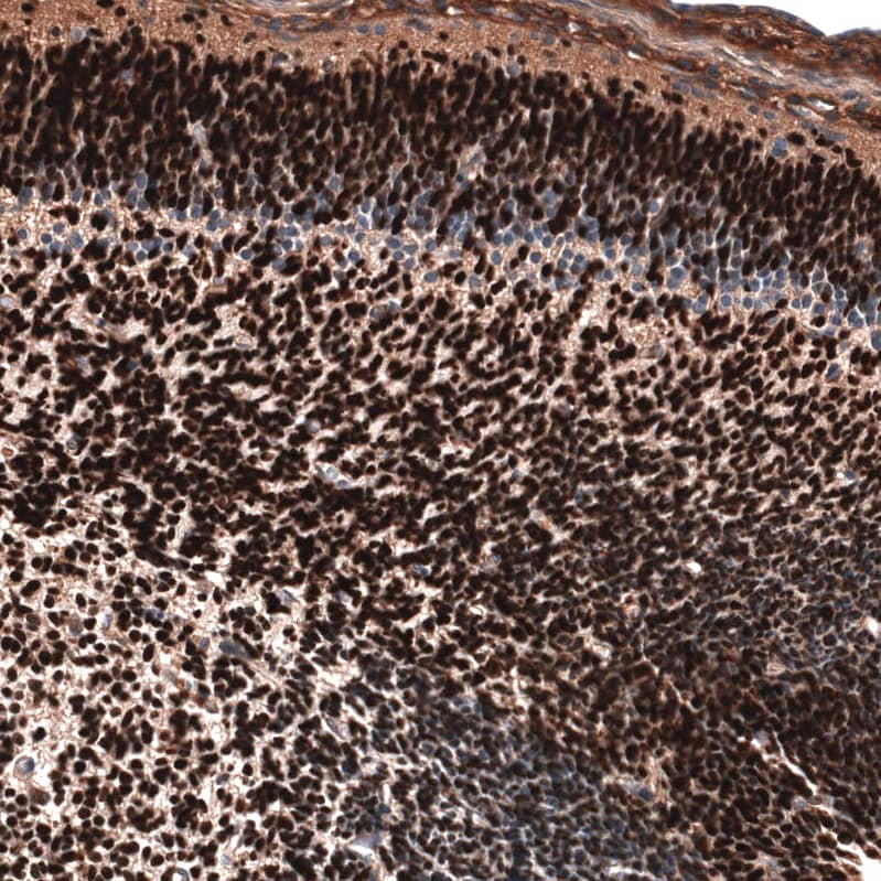 POU3F3 Antibody (CL15308) [Unconjugated] Immunohistochemistry-Paraffin: POU3F3 Antibody (CL15308) [NBP3-43660]