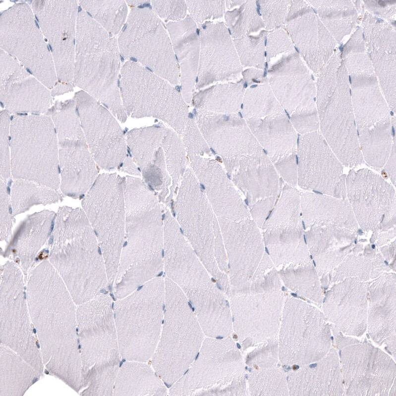 ELAVL2 Antibody (CL15323) [Unconjugated] Immunohistochemistry-Paraffin: ELAVL2 Antibody (CL15323) [NBP3-43661]