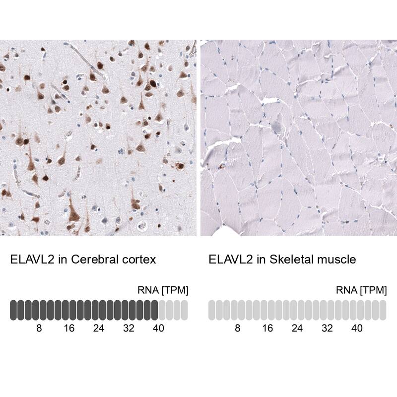 ELAVL2 Antibody (CL15323) [Unconjugated] Immunohistochemistry-Paraffin: ELAVL2 Antibody (CL15323) [NBP3-43661]