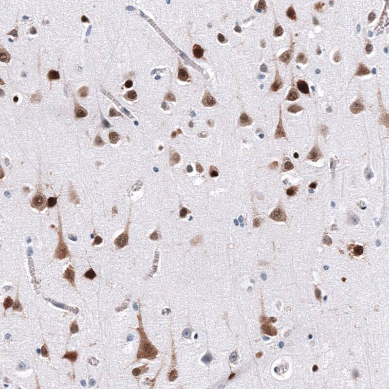 ELAVL2 Antibody (CL15323) [Unconjugated] Immunohistochemistry-Paraffin: ELAVL2 Antibody (CL15323) [NBP3-43661]