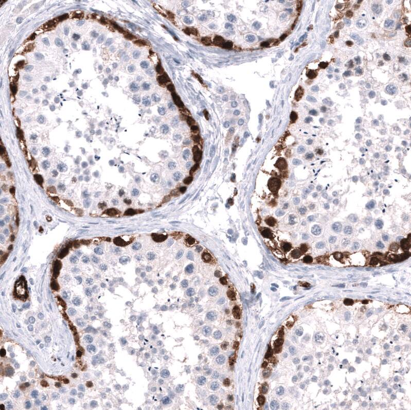 ELAVL2 Antibody (CL15323) [Unconjugated] Immunohistochemistry-Paraffin: ELAVL2 Antibody (CL15323) [NBP3-43661]