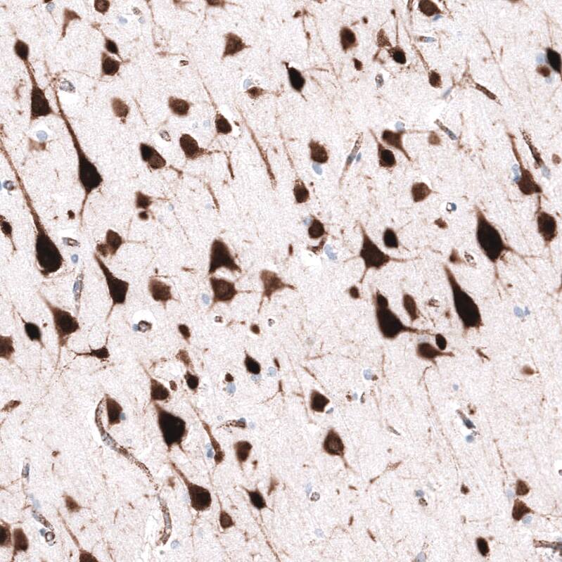 ELAVL2 Antibody (CL15329) [Unconjugated] Immunohistochemistry-Paraffin: ELAVL2 Antibody (CL15329) [NBP3-43662]