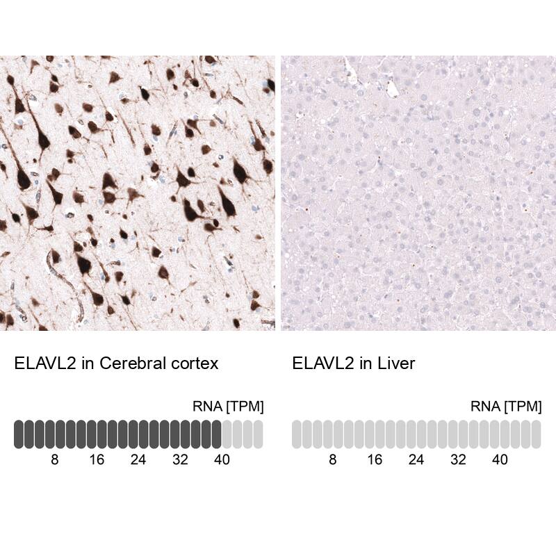 ELAVL2 Antibody (CL15329) [Unconjugated] Immunohistochemistry-Paraffin: ELAVL2 Antibody (CL15329) [NBP3-43662]