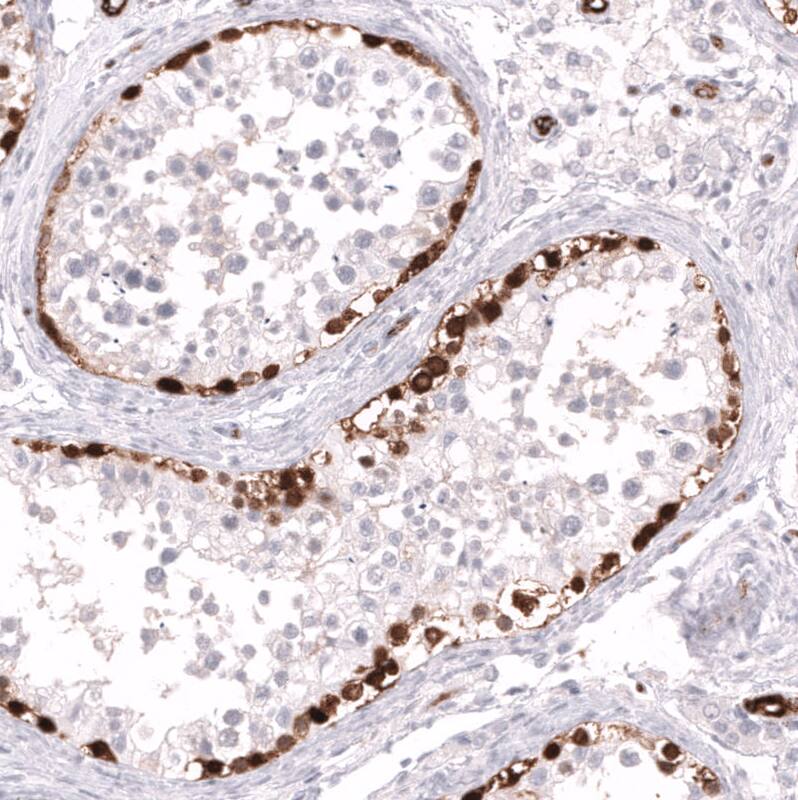 ELAVL2 Antibody (CL15329) [Unconjugated] Immunohistochemistry-Paraffin: ELAVL2 Antibody (CL15329) [NBP3-43662]