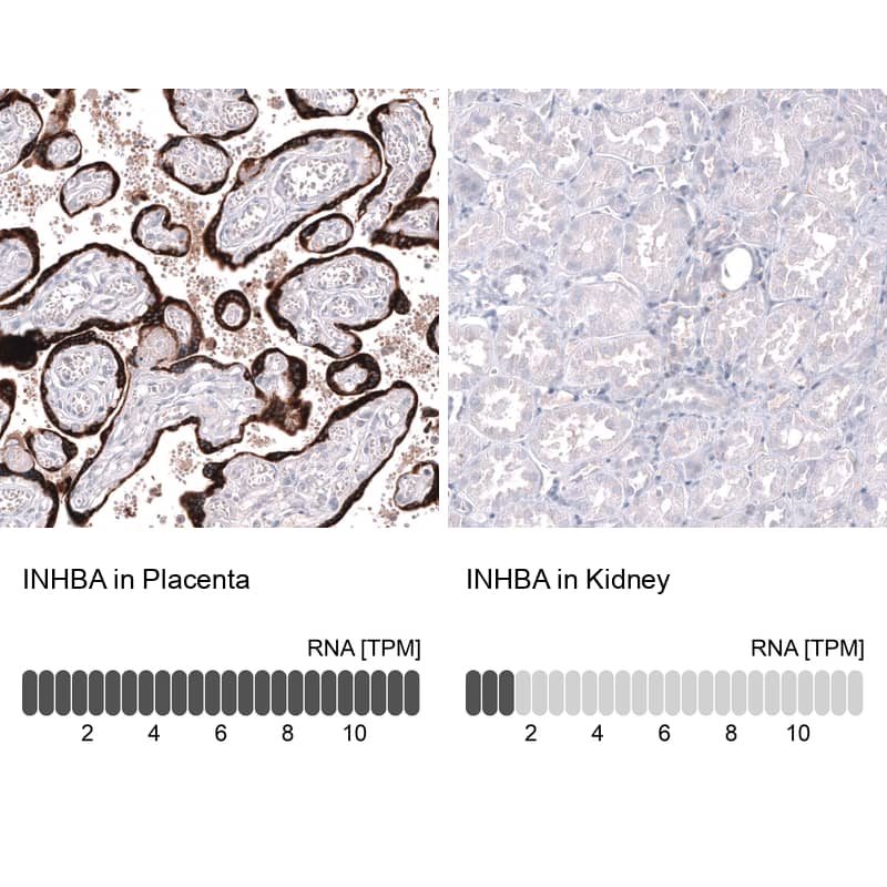 Inhibin beta A Antibody (CL15357) [Unconjugated] Immunohistochemistry-Paraffin: Inhibin beta A Antibody (CL15357) [NBP3-43663]