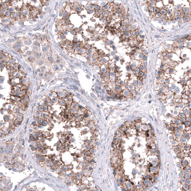 Nectin-3/PVRL3 Antibody (CL15364) [Unconjugated] Immunohistochemistry-Paraffin: Nectin-3/PVRL3 Antibody (CL15364) [NBP3-43664]