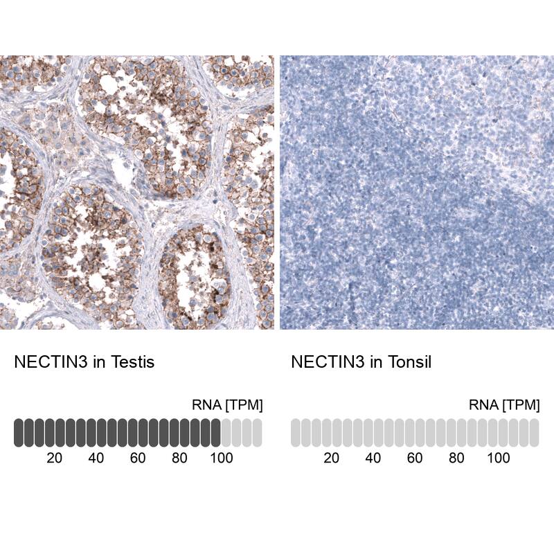 Nectin-3/PVRL3 Antibody (CL15364) [Unconjugated] Immunohistochemistry-Paraffin: Nectin-3/PVRL3 Antibody (CL15364) [NBP3-43664]