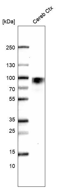 Nectin-3/PVRL3 Antibody (CL15364) [Unconjugated] Western blot: Nectin-3/PVRL3 Antibody (CL15364) [NBP3-43664]