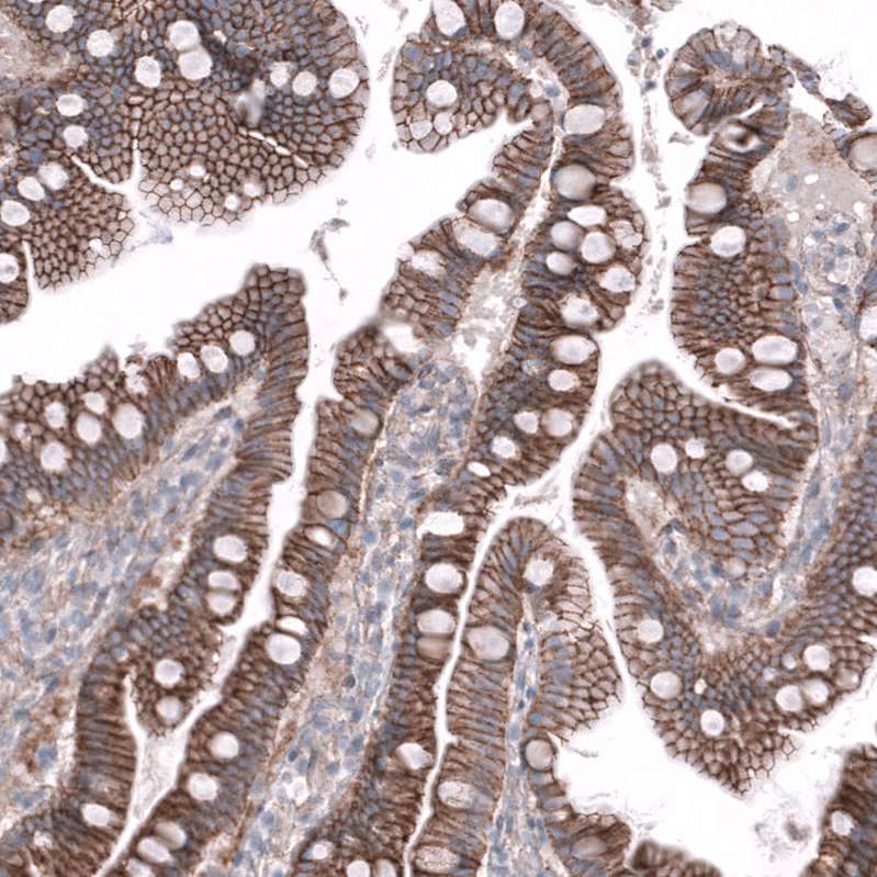 Nectin-3/PVRL3 Antibody (CL15366) [Unconjugated] Immunohistochemistry-Paraffin: Nectin-3/PVRL3 Antibody (CL15366) [NBP3-43665]