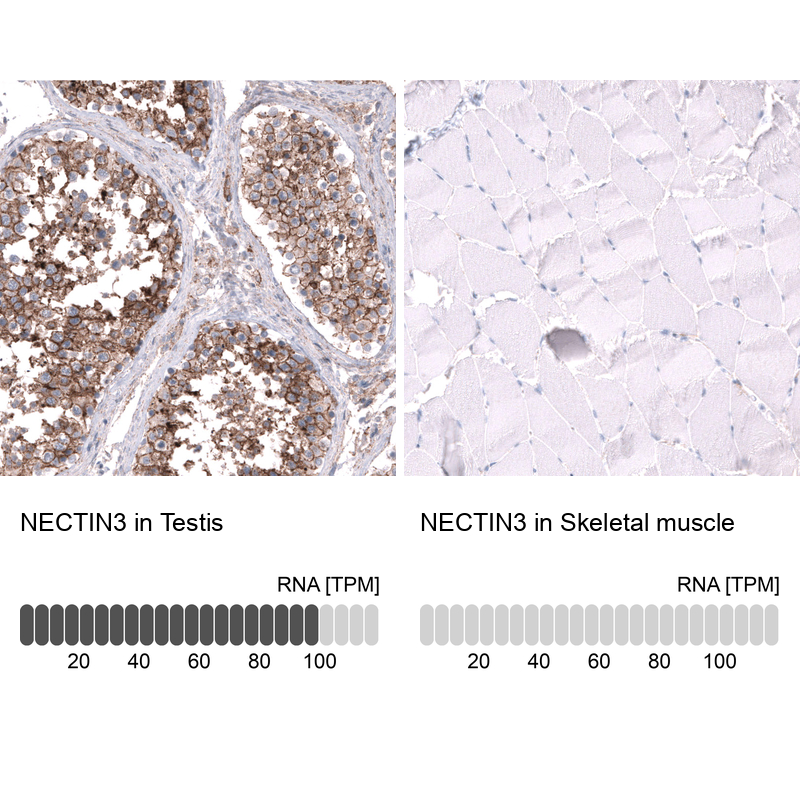 Nectin-3/PVRL3 Antibody (CL15366) [Unconjugated] Immunohistochemistry-Paraffin: Nectin-3/PVRL3 Antibody (CL15366) [NBP3-43665]