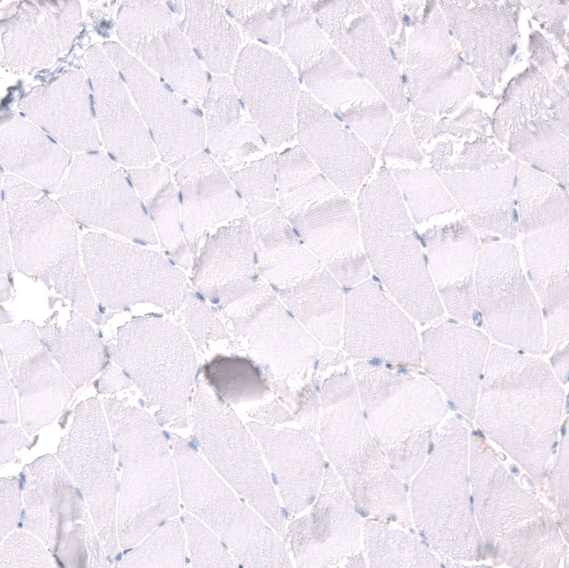 Nectin-3/PVRL3 Antibody (CL15366) [Unconjugated] Immunohistochemistry-Paraffin: Nectin-3/PVRL3 Antibody (CL15366) [NBP3-43665]