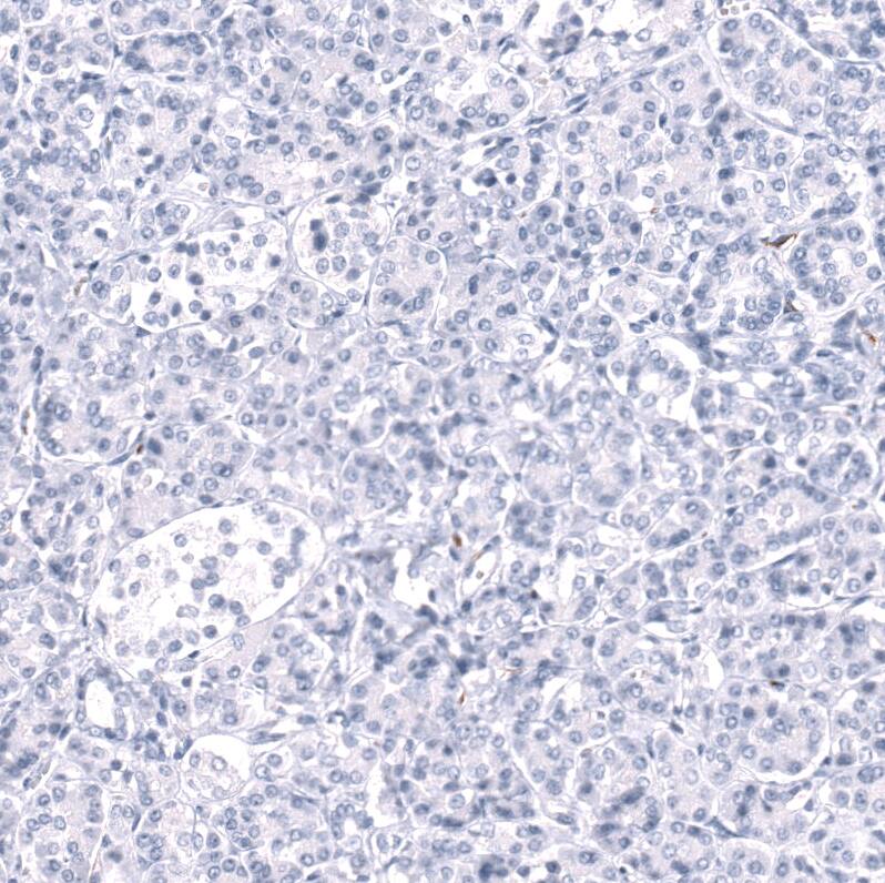 Cadherin-13 Antibody (CL15368) [Unconjugated] Immunohistochemistry-Paraffin: Cadherin-13 Antibody (CL15368) [NBP3-43666]