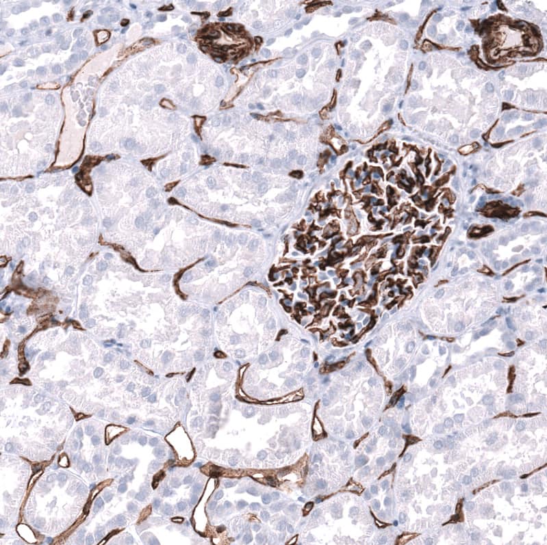 Cadherin-13 Antibody (CL15368) [Unconjugated] Immunohistochemistry-Paraffin: Cadherin-13 Antibody (CL15368) [NBP3-43666]