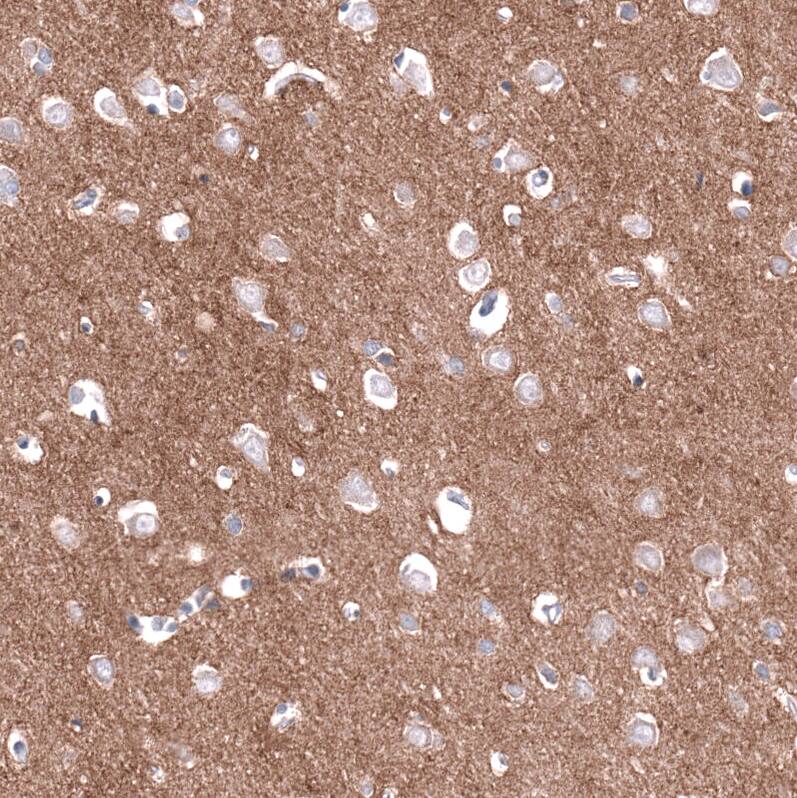 Cadherin-13 Antibody (CL15368) [Unconjugated] Immunohistochemistry-Paraffin: Cadherin-13 Antibody (CL15368) [NBP3-43666]