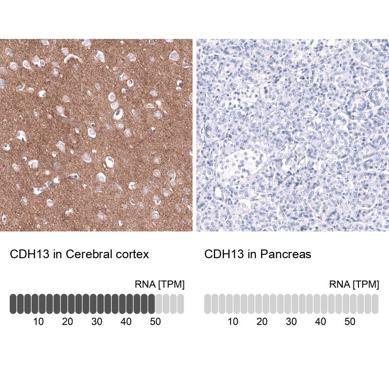 Cadherin-13 Antibody (CL15368) [Unconjugated] Immunohistochemistry-Paraffin: Cadherin-13 Antibody (CL15368) [NBP3-43666]