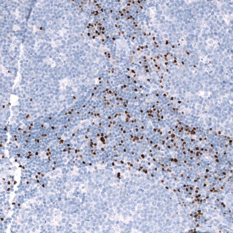 EOMES Antibody (CL15425) [Unconjugated] Immunohistochemistry-Paraffin: EOMES Antibody (CL15425) [NBP3-43667]