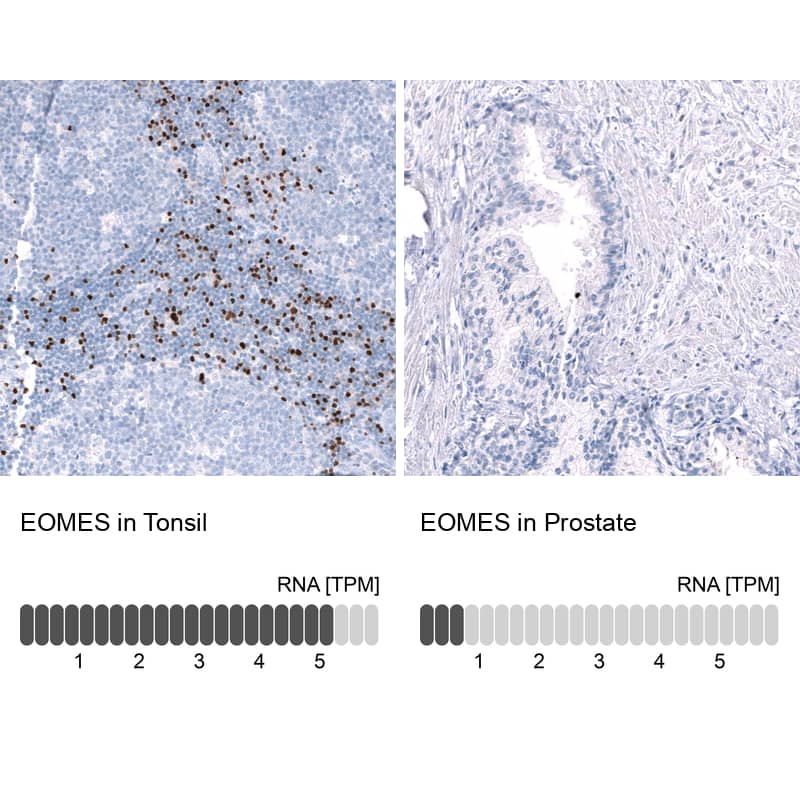 EOMES Antibody (CL15425) [Unconjugated] Immunohistochemistry-Paraffin: EOMES Antibody (CL15425) [NBP3-43667]