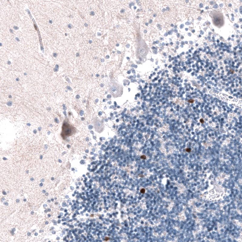 EOMES Antibody (CL15425) [Unconjugated] Immunohistochemistry-Paraffin: EOMES Antibody (CL15425) [NBP3-43667]