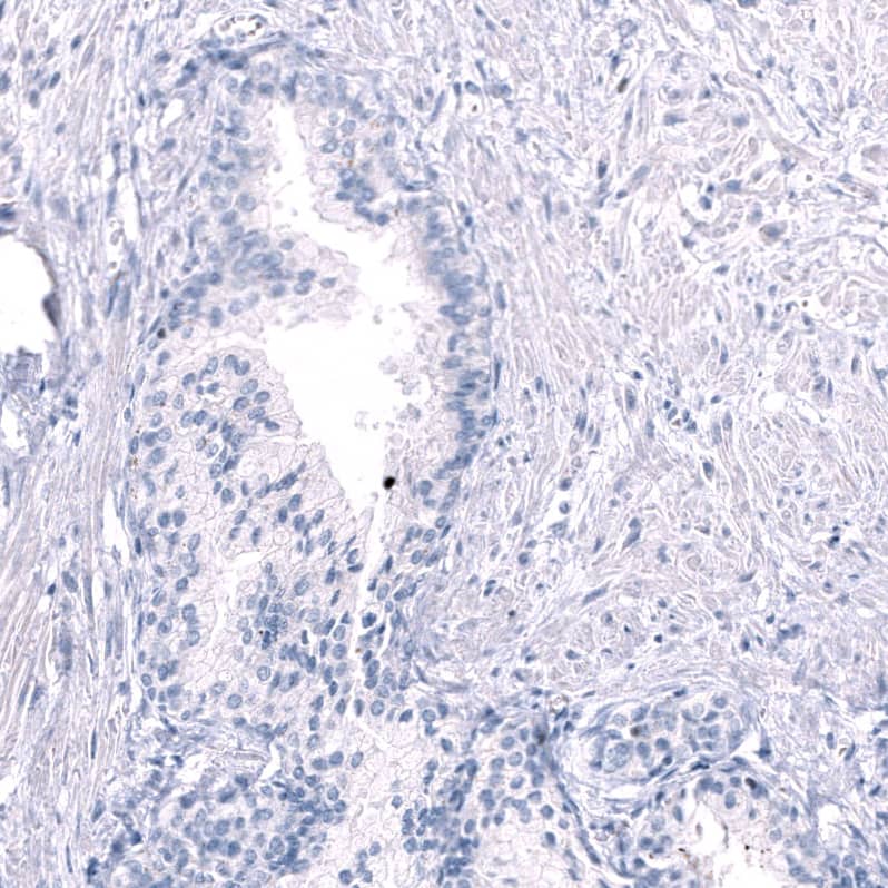 EOMES Antibody (CL15425) [Unconjugated] Immunohistochemistry-Paraffin: EOMES Antibody (CL15425) [NBP3-43667]