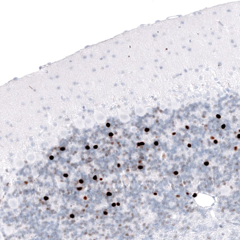 EOMES Antibody (CL15426) [Unconjugated] Immunohistochemistry-Paraffin: EOMES Antibody (CL15426) [NBP3-43668]